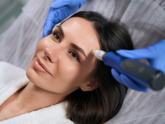 A woman lying down having the microneedling treatment on her forehead